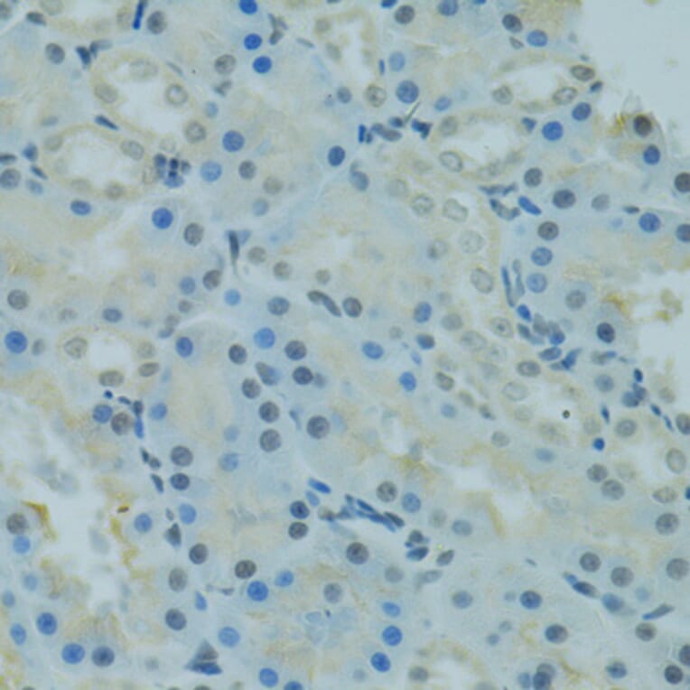 Immunohistochemistry - Anti-PRDM2 Antibody (A8565) - Antibodies.com