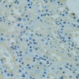 Immunohistochemistry - Anti-PRDM2 Antibody (A8565) - Antibodies.com