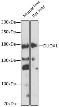 Western blot analysis of extracts of various cell lines, using Anti-DUOX1 Antibody (A8583) at 1:1,000 dilution.
Secondary antibody: Goat Anti-Rabbit IgG (H+L) (HRP) (AS014) at 1:10,000 dilution.
Lysates / proteins: 25µg per lane.
Blocking buffer: 3% non-fat dry milk in TBST.
Detection: ECL Enhanced Kit (RM00021).
Exposure time: 60s.