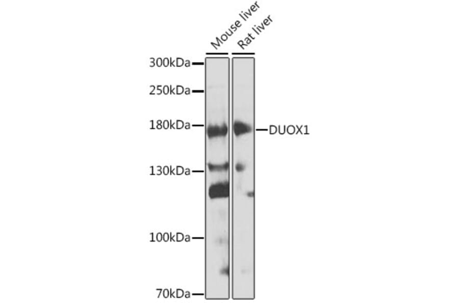 Western Blot - Anti-DUOX1 Antibody (A17293) - Antibodies.com