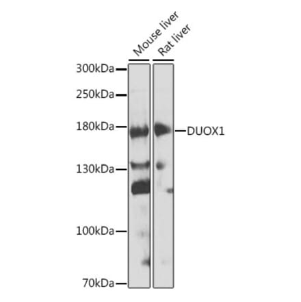 Western Blot - Anti-DUOX1 Antibody (A17293) - Antibodies.com