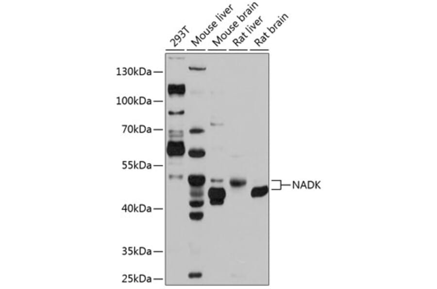 Western Blot - Anti-NADK Antibody (A17294) - Antibodies.com