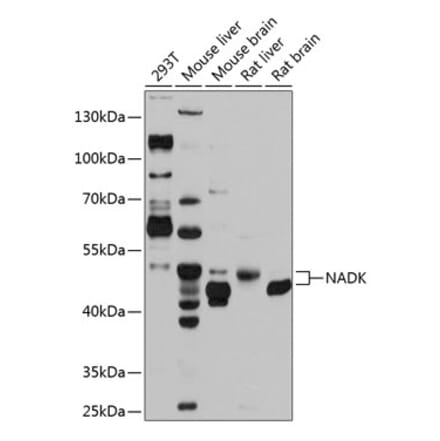 Western Blot - Anti-NADK Antibody (A17294) - Antibodies.com