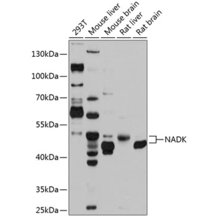 Western Blot - Anti-NADK Antibody (A17294) - Antibodies.com