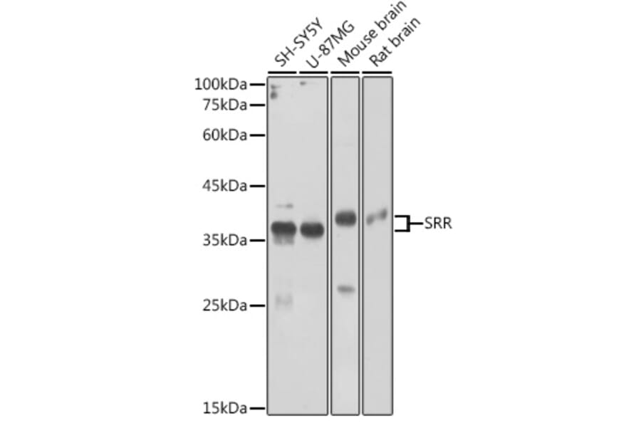 Western Blot - Anti-Serine racemase Antibody (A17295) - Antibodies.com