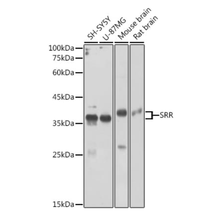 Western Blot - Anti-Serine racemase Antibody (A17295) - Antibodies.com