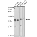 Western Blot - Anti-Serine racemase Antibody (A17295) - Antibodies.com