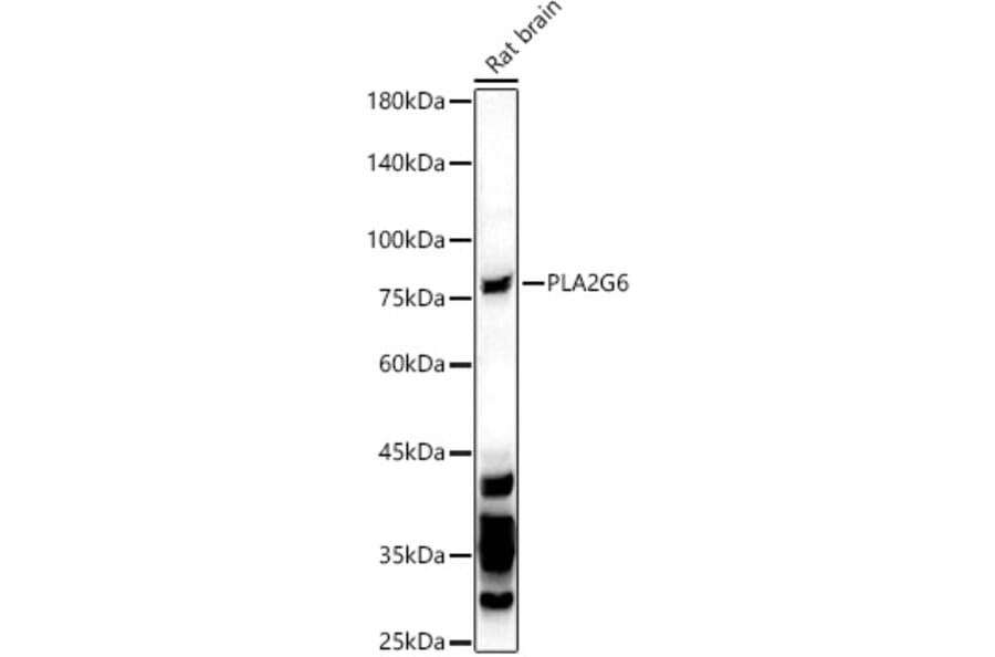 Western Blot - Anti-Calcium-independent phospholipase A2/PLA2G6 Antibody (A17296) - Antibodies.com