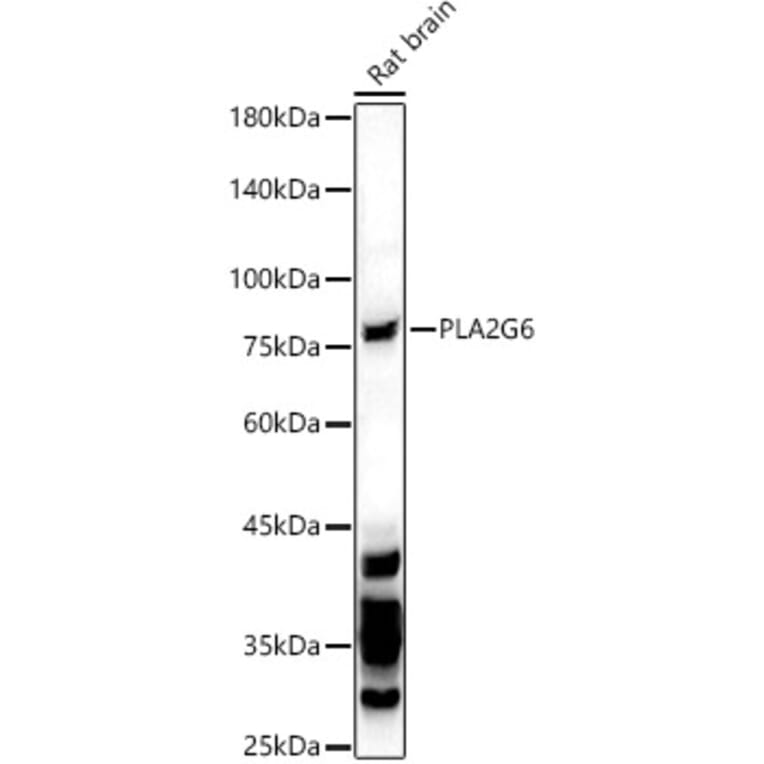 Western Blot - Anti-Calcium-independent phospholipase A2/PLA2G6 Antibody (A17296) - Antibodies.com