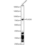 Western Blot - Anti-Calcium-independent phospholipase A2/PLA2G6 Antibody (A17296) - Antibodies.com