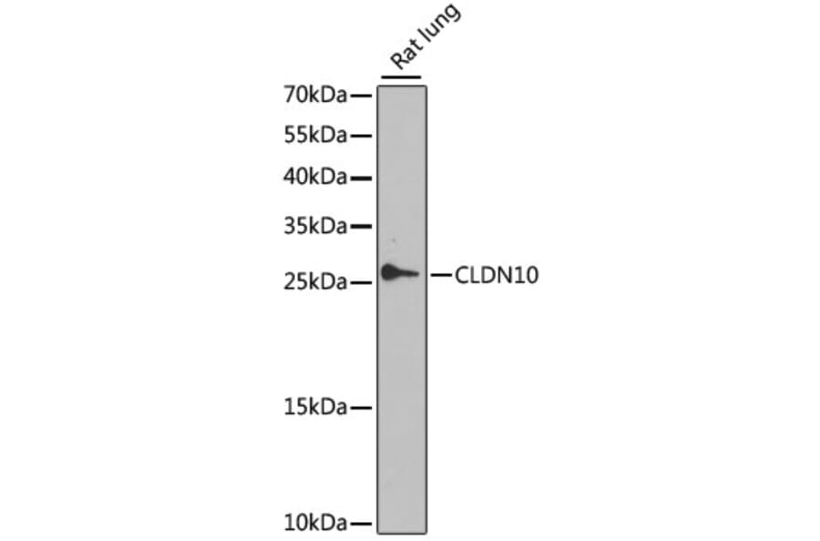 Western Blot - Anti-Claudin 10 Antibody (A17297) - Antibodies.com