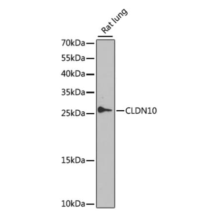 Western Blot - Anti-Claudin 10 Antibody (A17297) - Antibodies.com