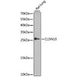 Western Blot - Anti-Claudin 10 Antibody (A17297) - Antibodies.com