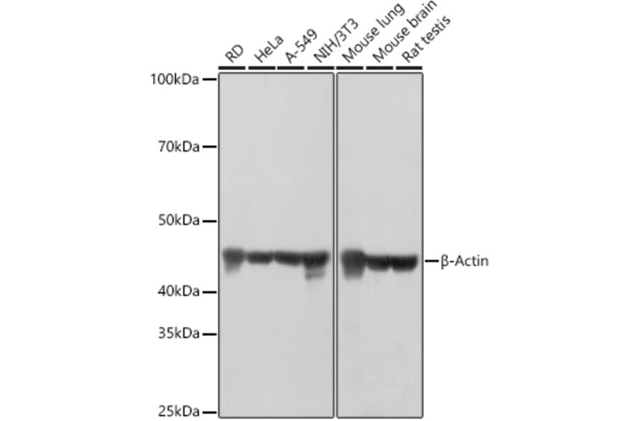 Western Blot - Anti-beta Actin Antibody [AMC0001] (A17299) - Antibodies.com
