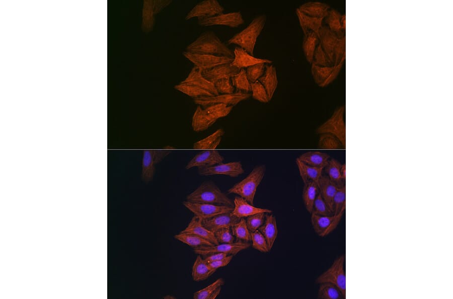 Immunofluorescence - Anti-beta Actin Antibody [AMC0001] (A17299) - Antibodies.com