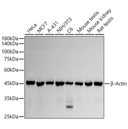 Western Blot - Anti-beta Actin Antibody (A17300) - Antibodies.com