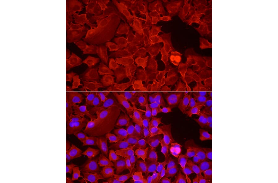 Immunofluorescence - Anti-GAPDH Antibody (A17302) - Antibodies.com