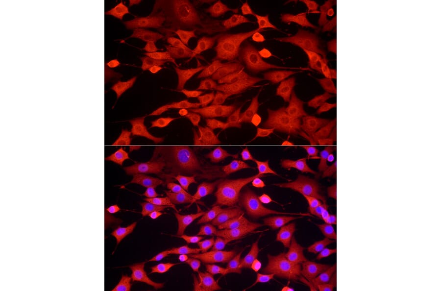 Immunofluorescence - Anti-GAPDH Antibody (A17302) - Antibodies.com