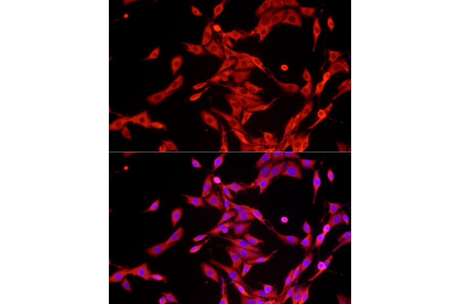 Immunofluorescence - Anti-GAPDH Antibody (A17302) - Antibodies.com