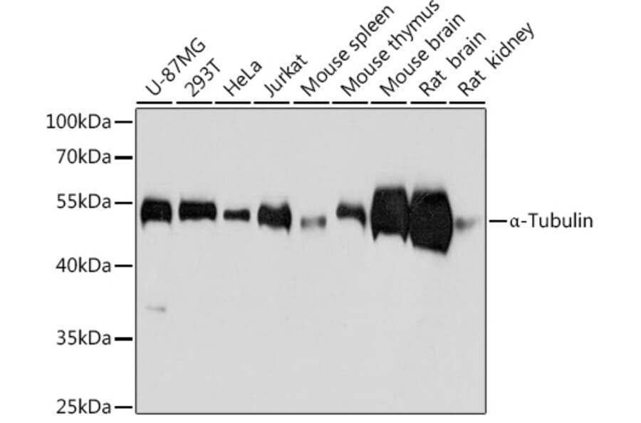 Western Blot - Anti-alpha Tubulin Antibody [AMC0479] (A17303) - Antibodies.com