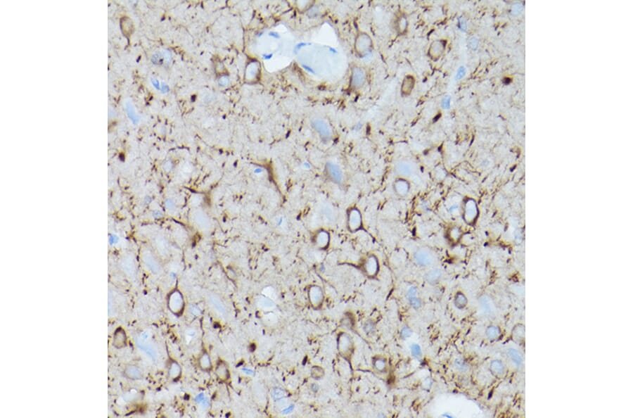 Immunohistochemistry - Anti-alpha Tubulin Antibody [AMC0479] (A17303) - Antibodies.com