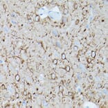 Immunohistochemistry - Anti-alpha Tubulin Antibody [AMC0479] (A17303) - Antibodies.com