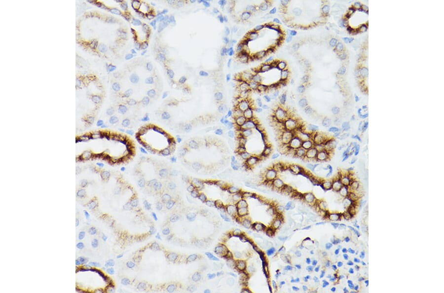 Immunohistochemistry - Anti-alpha Tubulin Antibody [AMC0479] (A17303) - Antibodies.com