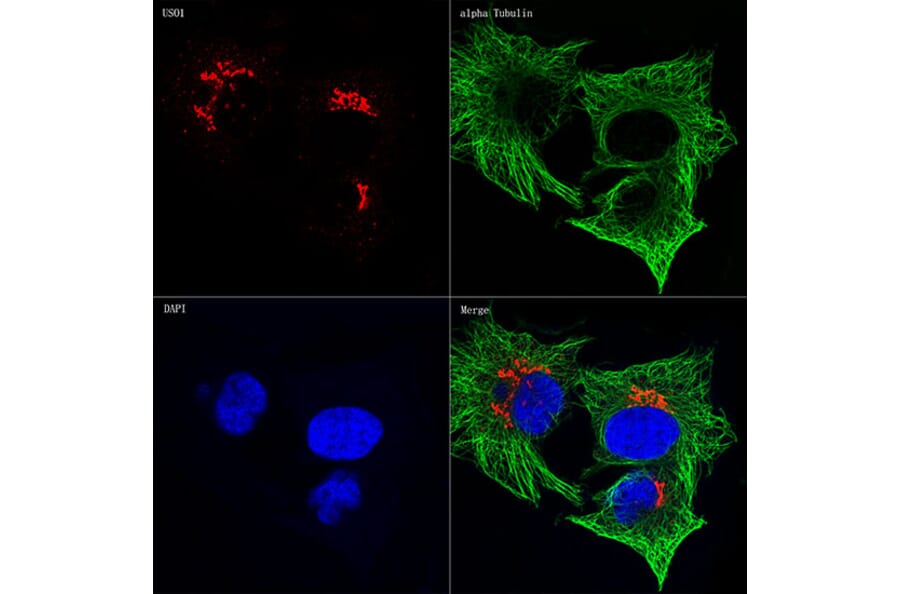 Immunofluorescence - Anti-alpha Tubulin Antibody [AMC0479] (A17303) - Antibodies.com