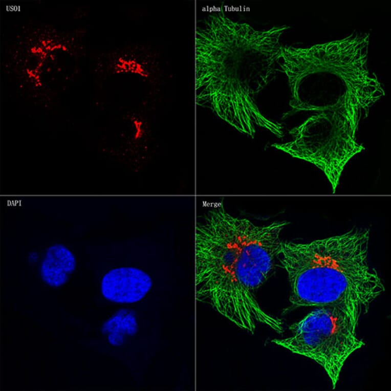 Immunofluorescence - Anti-alpha Tubulin Antibody [AMC0479] (A17303) - Antibodies.com