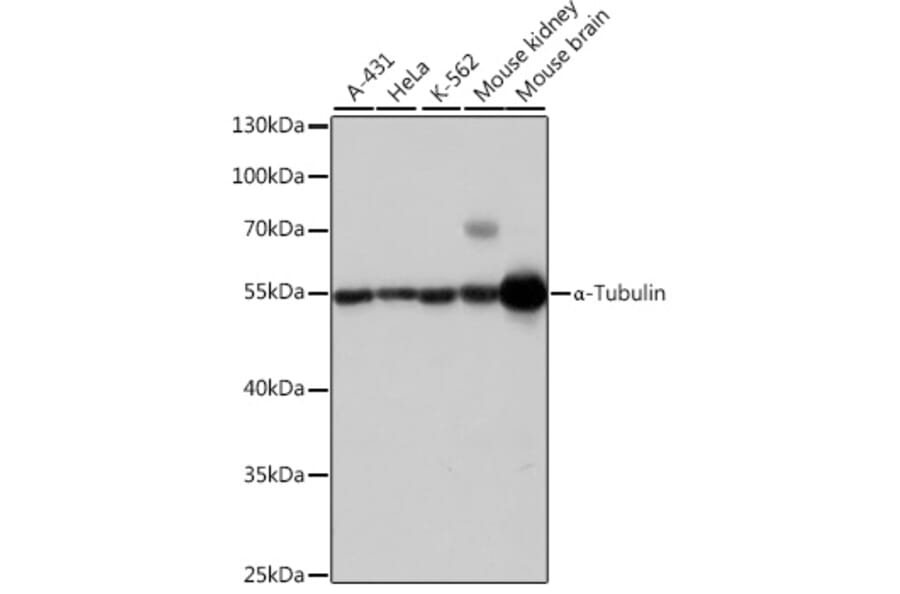 Western Blot - Anti-alpha Tubulin Antibody (A17304) - Antibodies.com