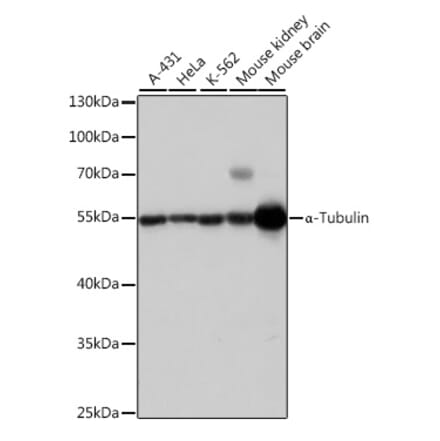Western Blot - Anti-alpha Tubulin Antibody (A17304) - Antibodies.com