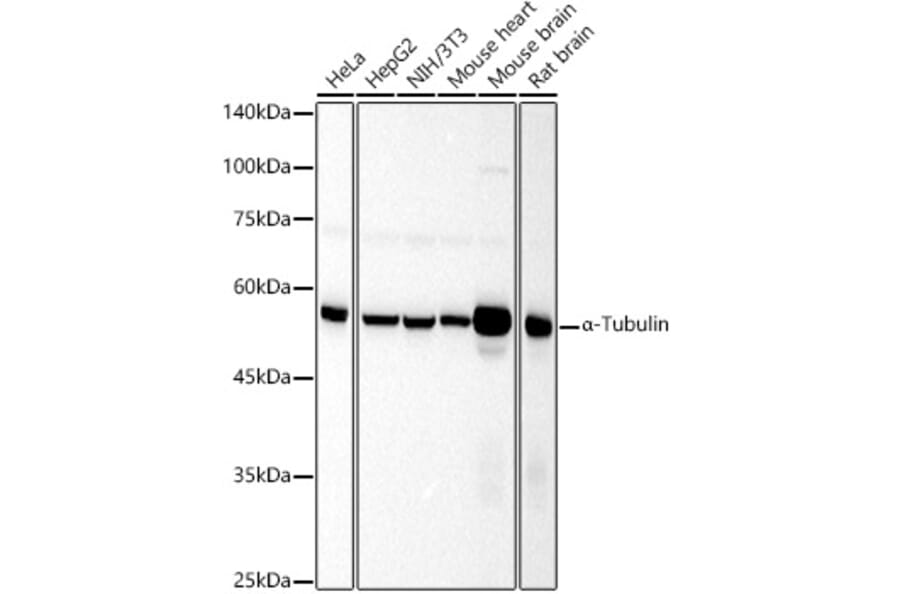 Western Blot - Anti-alpha Tubulin Antibody (A17304) - Antibodies.com