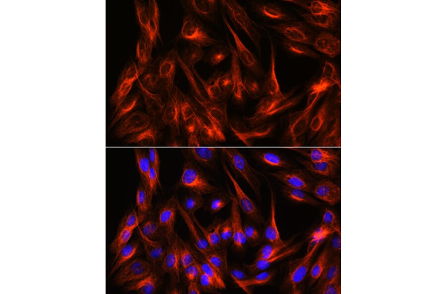 Immunofluorescence - Anti-alpha Tubulin Antibody (A17304) - Antibodies.com