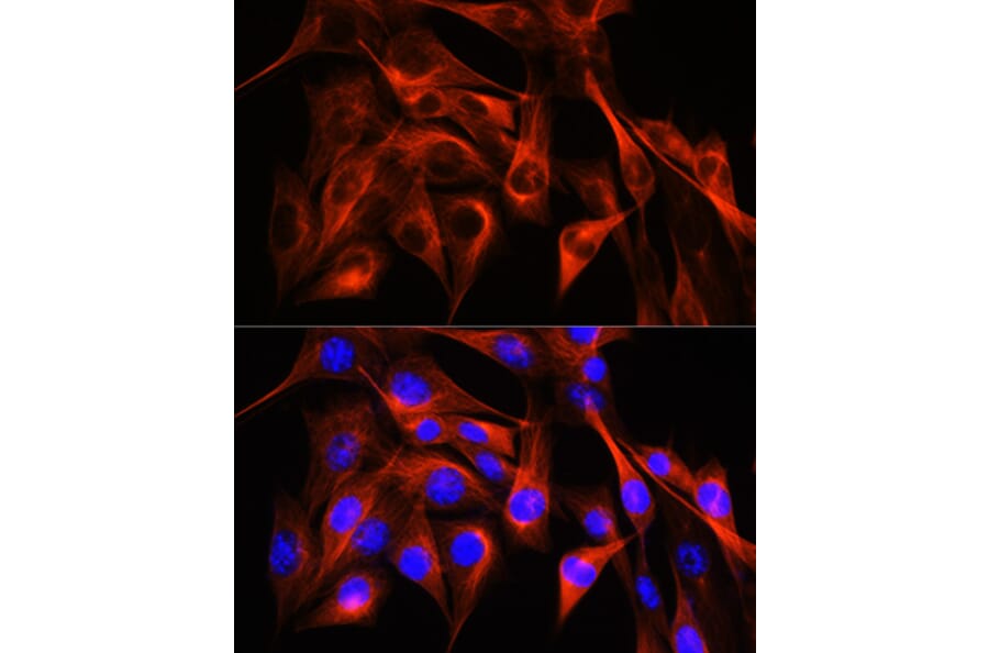 Immunofluorescence - Anti-alpha Tubulin Antibody (A17304) - Antibodies.com