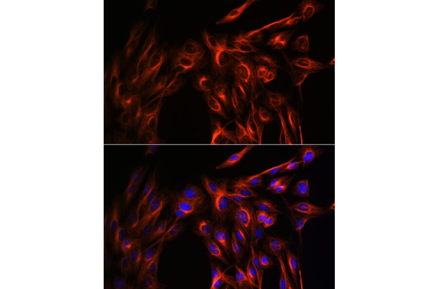 Immunofluorescence - Anti-alpha Tubulin Antibody (A17304) - Antibodies.com