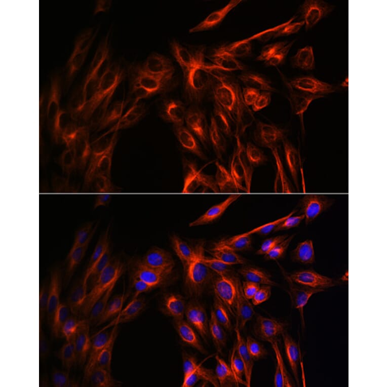 Immunofluorescence - Anti-alpha Tubulin Antibody (A17304) - Antibodies.com