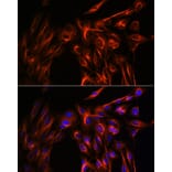 Immunofluorescence - Anti-alpha Tubulin Antibody (A17304) - Antibodies.com