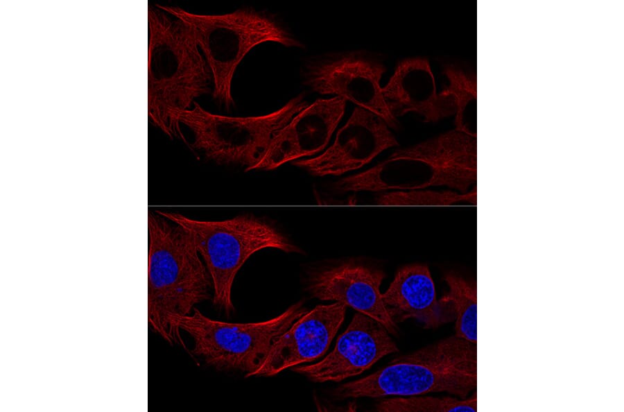 Immunofluorescence - Anti-alpha Tubulin Antibody (A17304) - Antibodies.com