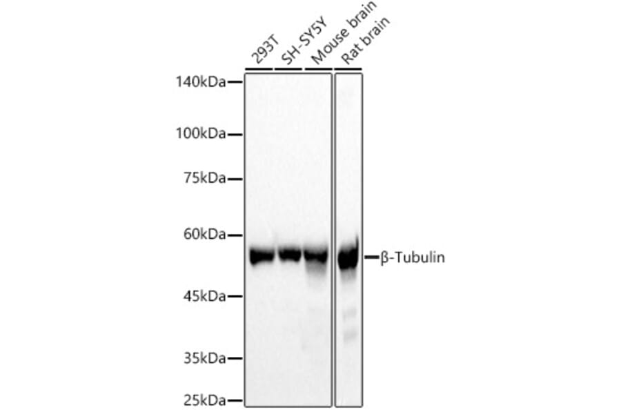 Western Blot - Anti-beta Tubulin Antibody (A17307) - Antibodies.com