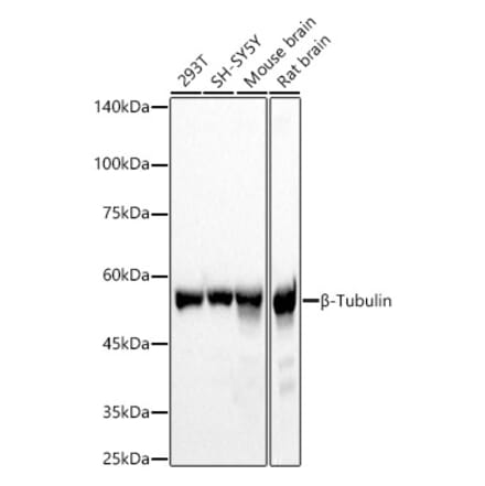 Western Blot - Anti-beta Tubulin Antibody (A17307) - Antibodies.com