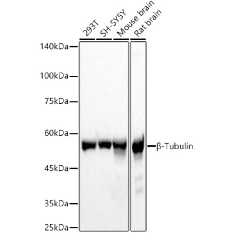 Western Blot - Anti-beta Tubulin Antibody (A17307) - Antibodies.com
