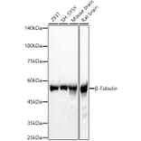 Western Blot - Anti-beta Tubulin Antibody (A17307) - Antibodies.com