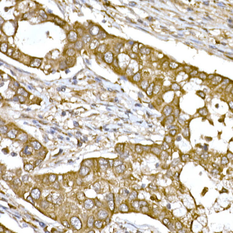 Immunohistochemistry - Anti-beta Tubulin Antibody (A17307) - Antibodies.com