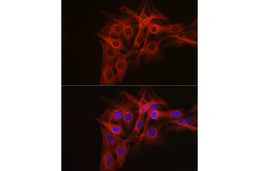 Immunofluorescence - Anti-beta Tubulin Antibody (A17307) - Antibodies.com