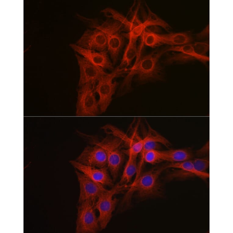 Immunofluorescence - Anti-beta Tubulin Antibody (A17307) - Antibodies.com