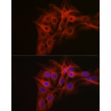 Immunofluorescence - Anti-beta Tubulin Antibody (A17307) - Antibodies.com
