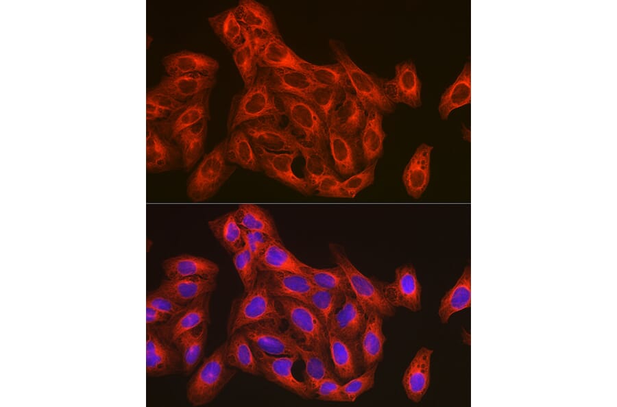 Immunofluorescence - Anti-beta Tubulin Antibody (A17307) - Antibodies.com