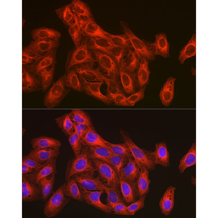 Immunofluorescence - Anti-beta Tubulin Antibody (A17307) - Antibodies.com