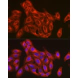 Immunofluorescence - Anti-beta Tubulin Antibody (A17307) - Antibodies.com