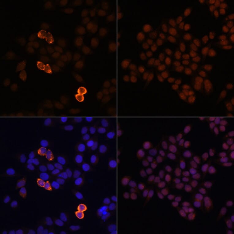 Immunofluorescence - Anti-Myc Tag Antibody (A17324) - Antibodies.com